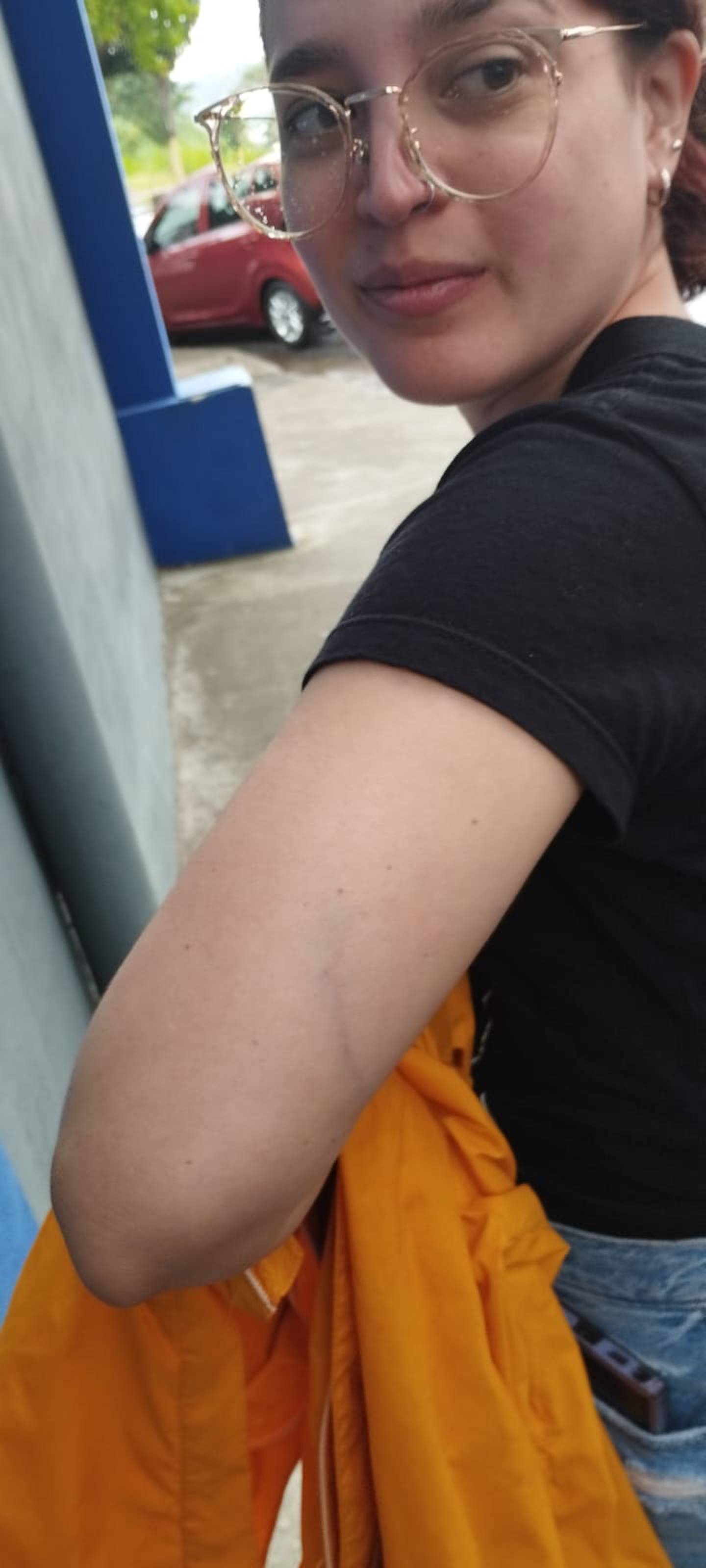 La diputada recibió un macanazo en el brazo izquierdo.