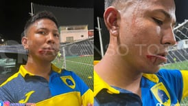 Escorpiones de Belén denuncia brutal agresión contra uno de sus futbolistas