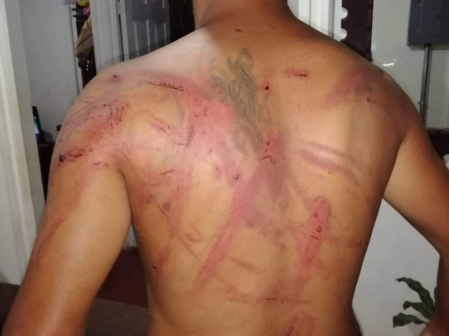 Joven denuncia que atacado por grupo de "garroteros" por delito que no cometió. Foto suministrada por Edgar Chinchilla.
