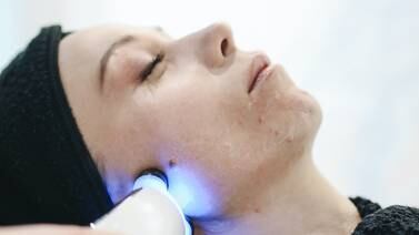 Innovadores tratamientos de radiofrecuencia para combatir la laxitud de la piel