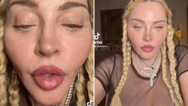 Grammy 2022: Madonna preocupa a fans por ‘TikTok’ previo a la gala