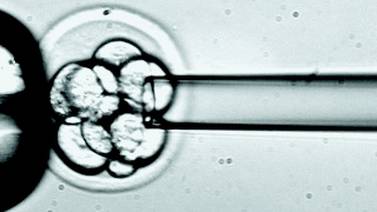 Tratan primer paciente con células madre embrionarias