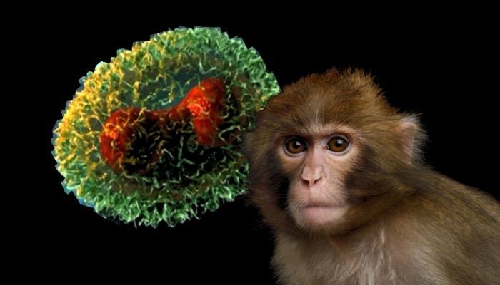 Salud confirma muerte de hombre de 30 años con viruela del mono
