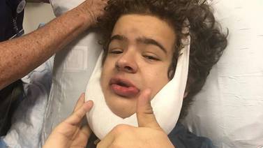 Gaten Matarazzo, de ‘Stranger Things’, se sometió a cuarta operación por su rara enfermedad: le extrajeron 14 dientes