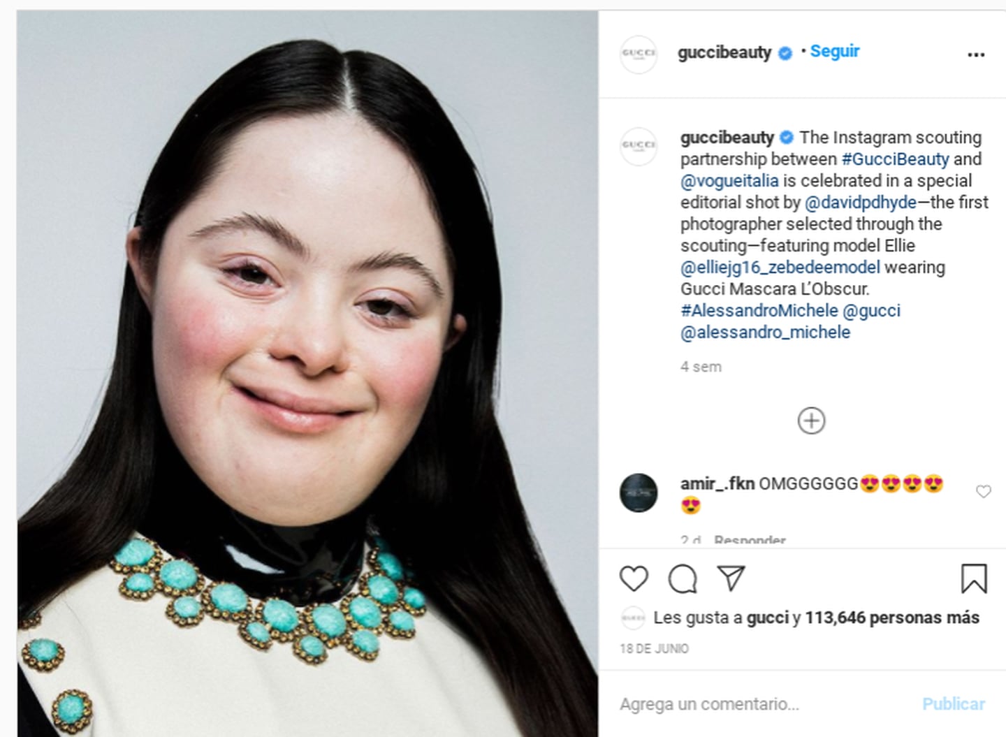 La historia de Ellie Goldstein, la modelo con síndrome de Down que causa  sensación en Gucci y 'Vogue' | La Nación