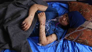 ‘¡Devuélvanme mis piernas!’: el grito de niños amputados en la guerra de Gaza