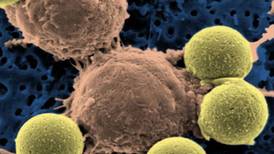  Linfocitos modificados genéticamente exterminan tumor que causa la leucemia