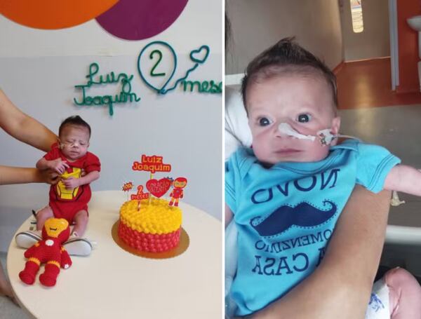 Tras el nacimiento, el bebé fue trasladado a cuidados intensivos y sometido a cirugías cardiacas.