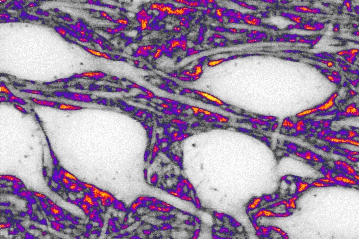 (Foto de ARCHIVO)
Imagen de neuronas en blanco y espacio extracelular en color.
REMITIDA / HANDOUT por JAN TONNESEN
Fotografía remitida a medios de comunicación exclusivamente para ilustrar la noticia a la que hace referencia la imagen, y citando la procedencia de la imagen en la firma
24/4/2026