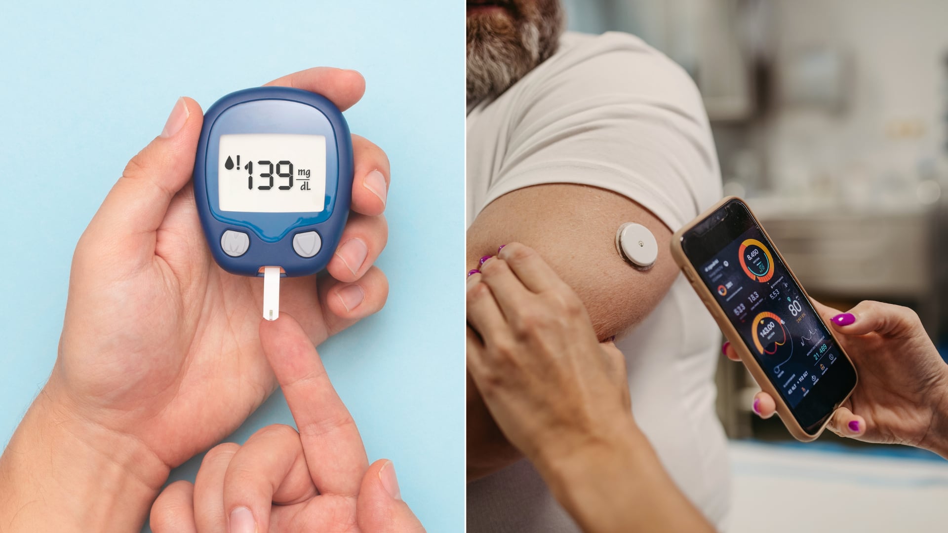 Monitor continuo de glucosa permite a las personas con diabetes conocer en tiempo real sus niveles de azúcar y actuar para prevenir picos de glucosa que pueden afectar la salud. En la imagen, el dispositivo FreeStyle Libre 2 Plus colocado en el brazo de un paciente.