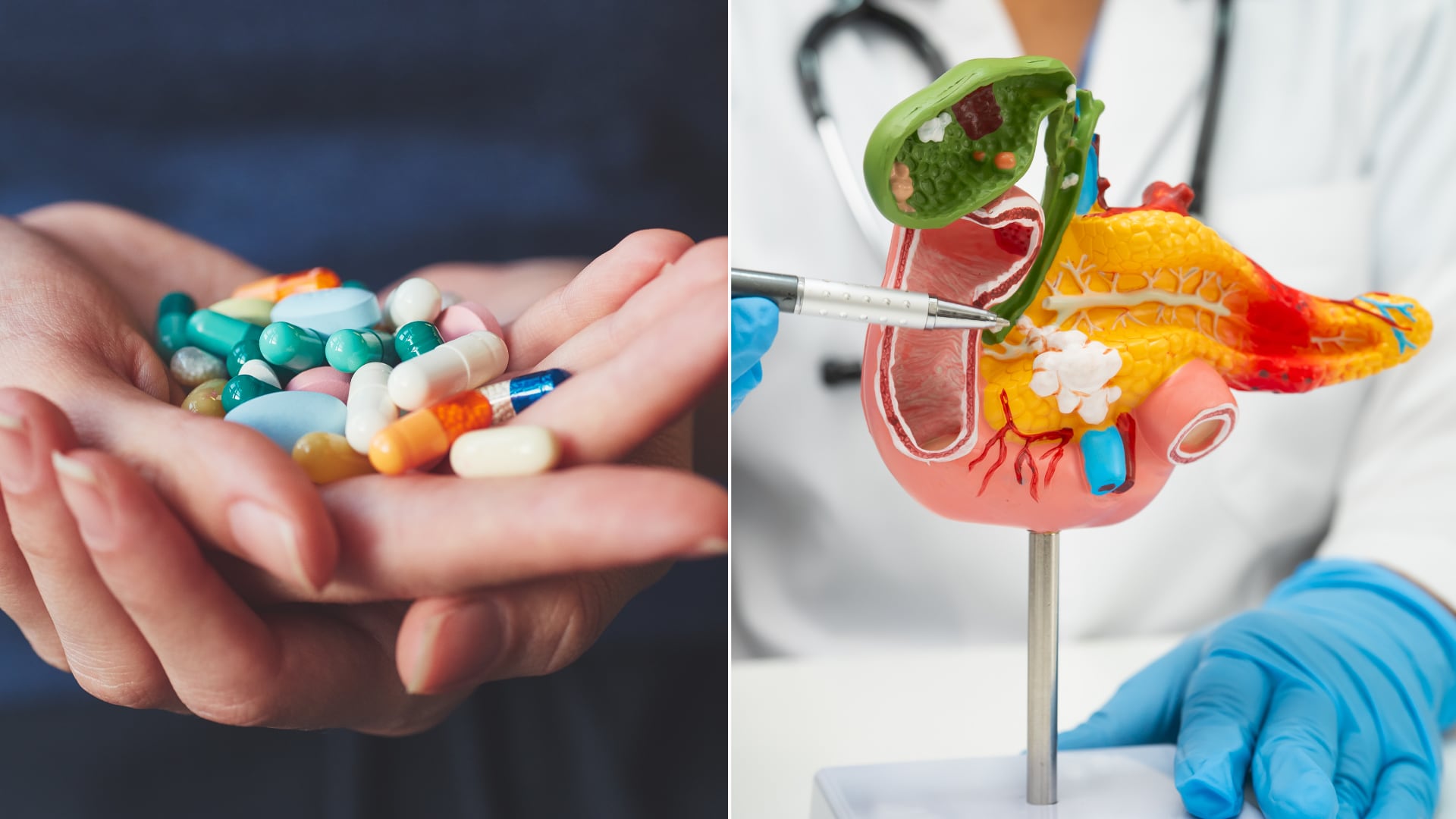 Ensayos clínicos muestran que nuevos tratamientos pueden prolongar la vida de pacientes con cáncer de páncreas.