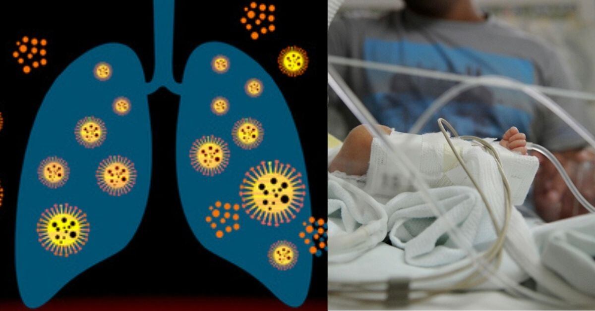 El Hospital Nacional de Niños vive saturación por virus respiratorios.
Composición hecha con fotografías de archivo
