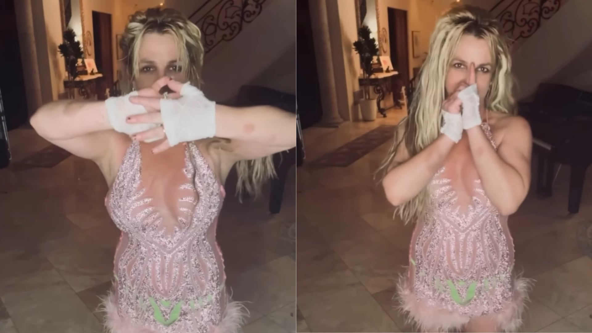 La cantante explicó que cayó por unas escaleras y mostró preocupación por la posible fractura en su pierna