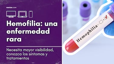 Daniela Latino, microbióloga: ‘La hemofilia puede pasar desapercibida en sus primeras etapas’|Videopodcast Mi Bienestar T2 - E4