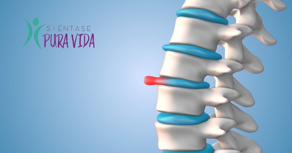 Una ilustración de una hernia de disco y el logo de la sección Siéntase Pura Vida