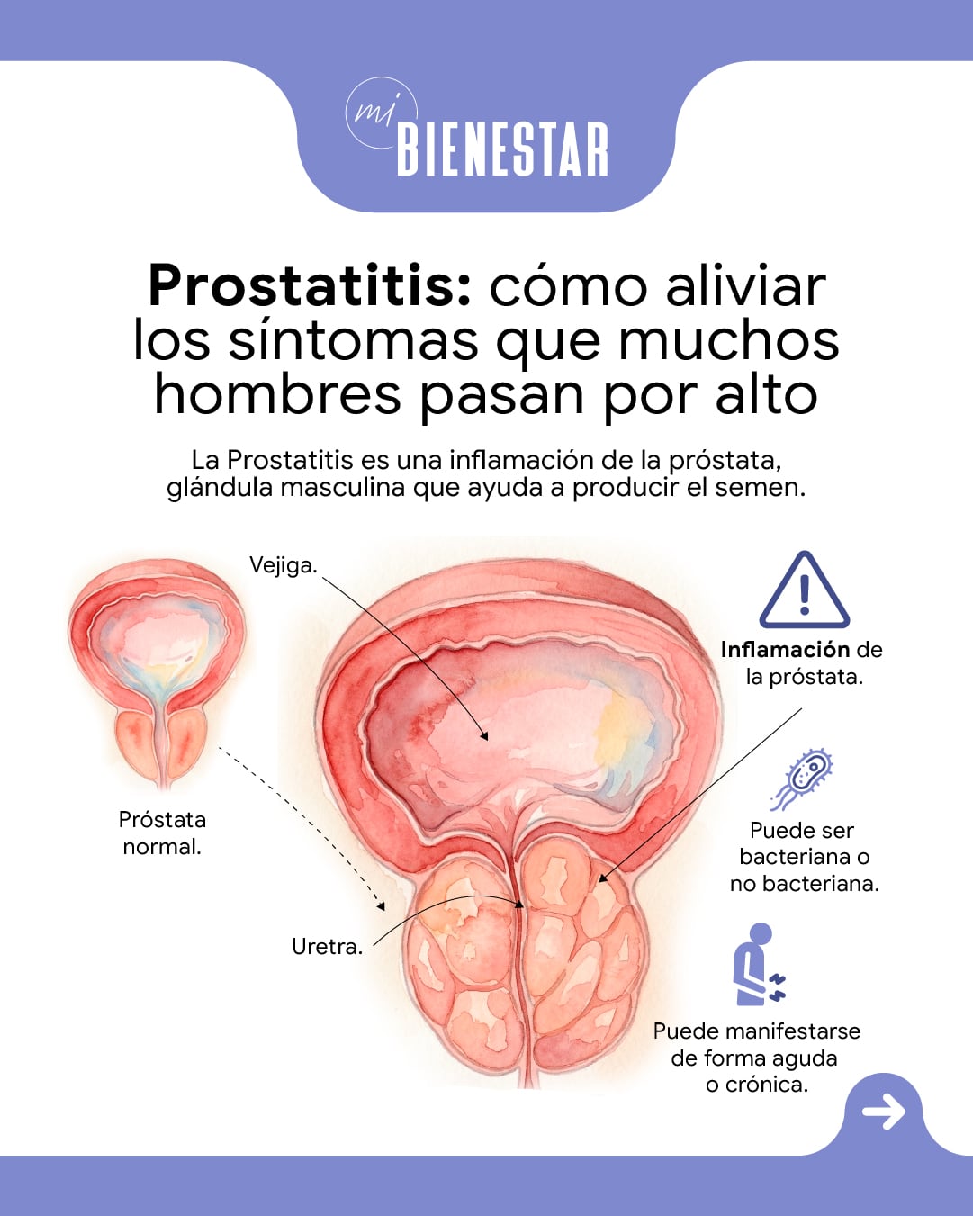 prostatitis
