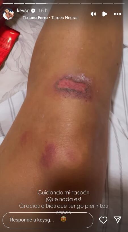 Keyla Sánchez gradeció la preocupación de sus seguidores y dijo que el golpe “no fue nada grave”.