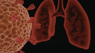 Descubren proteína que permite al cáncer evadir el sistema inmunológico y agrava tumores de pulmón y páncreas