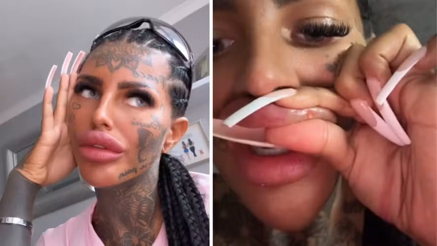 El video donde el relleno labial se escapa de los labios de una influencer británica causó furor en TikTok y suma millones de vistas.