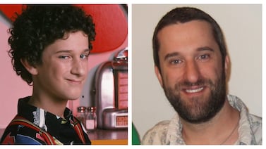 Dustin Diamond, estrella de ‘Salvados por la campana’ padece un cáncer muy avanzado