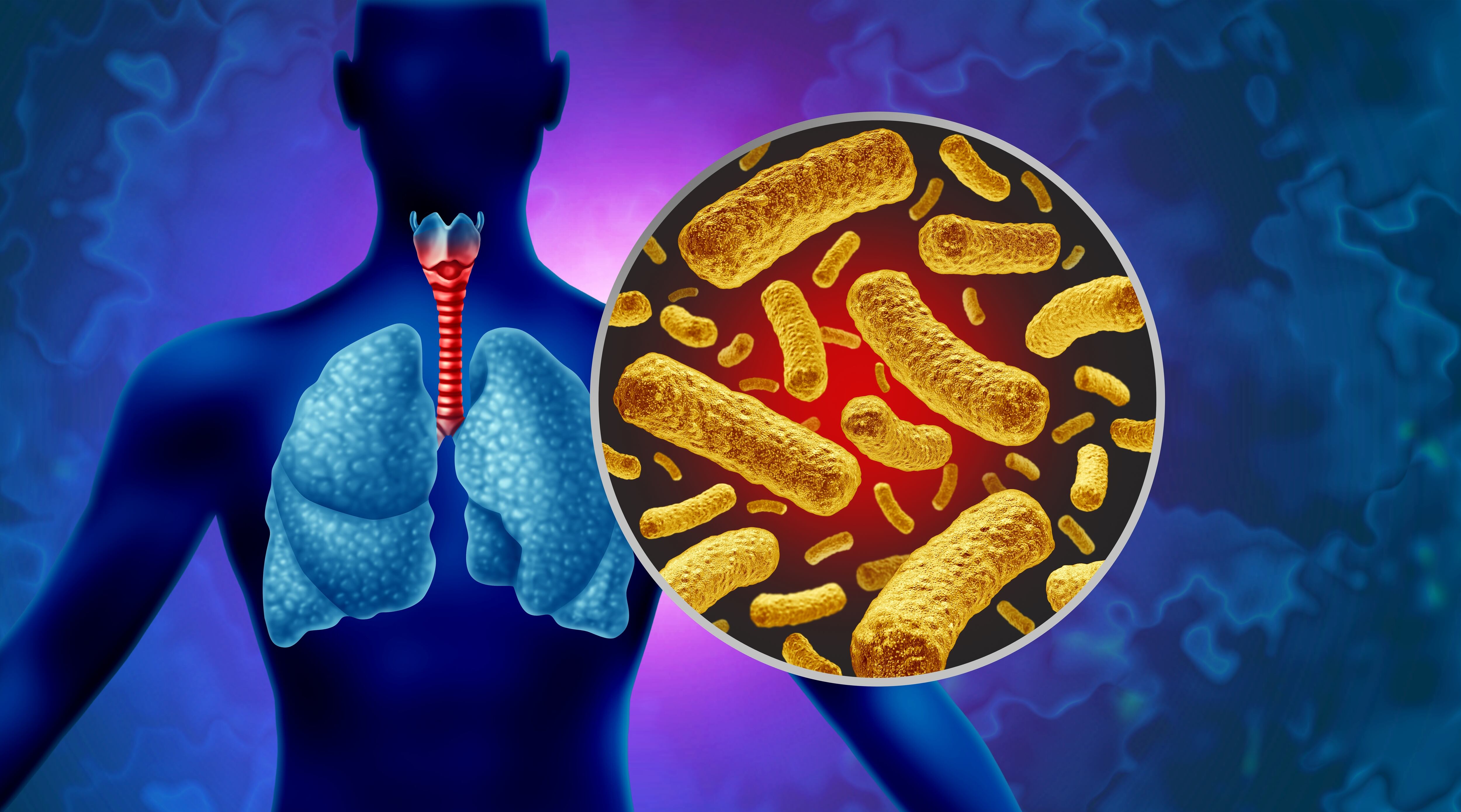 Una ilustración científica donde se ve la bacteria Bordetella pertussis, causante de la tosferina y unos pulmones, sitio atacado con la bacteria.