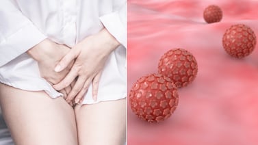 ¿Cómo se transmite el virus del papiloma humano y cómo detectarlo a tiempo?