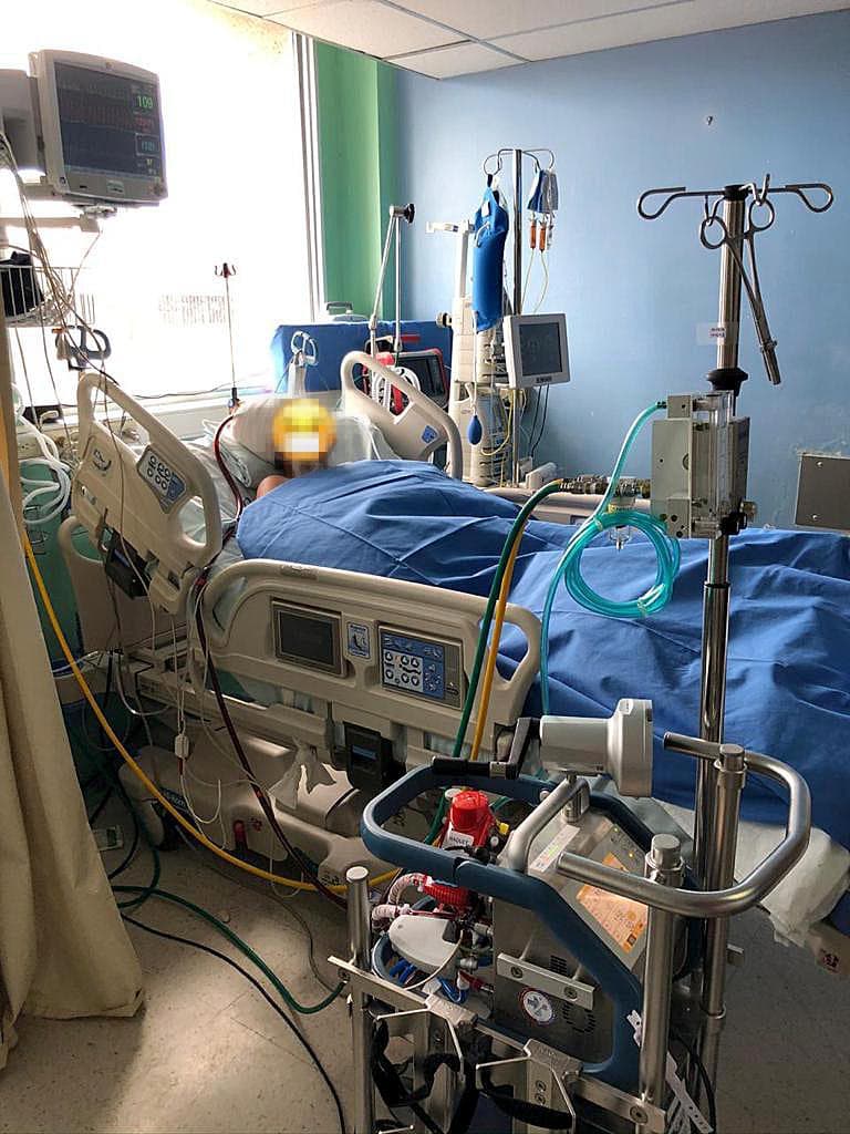 08/05/2021 Tratamiento con ECMO, o pulmón y corazón artificial, para enfermos de covid-19, en el Centro Nacional de Referencia de ECMO de la CCSS, en el Hospital Calderón Guardia. Foto: Jorge Ramírez para LN