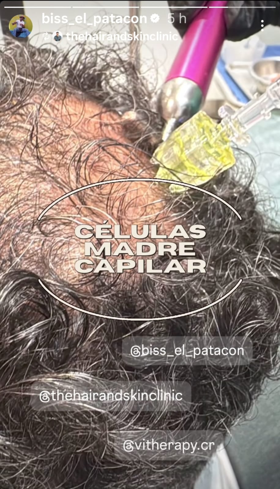 Bismarck Méndez De boca en boca