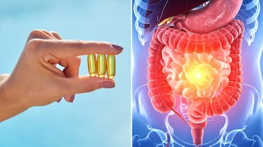 Vitamina D y flora intestinal: investigación en Estados Unidos revela cómo este suplemento frena el ataque de las defensas al intestino