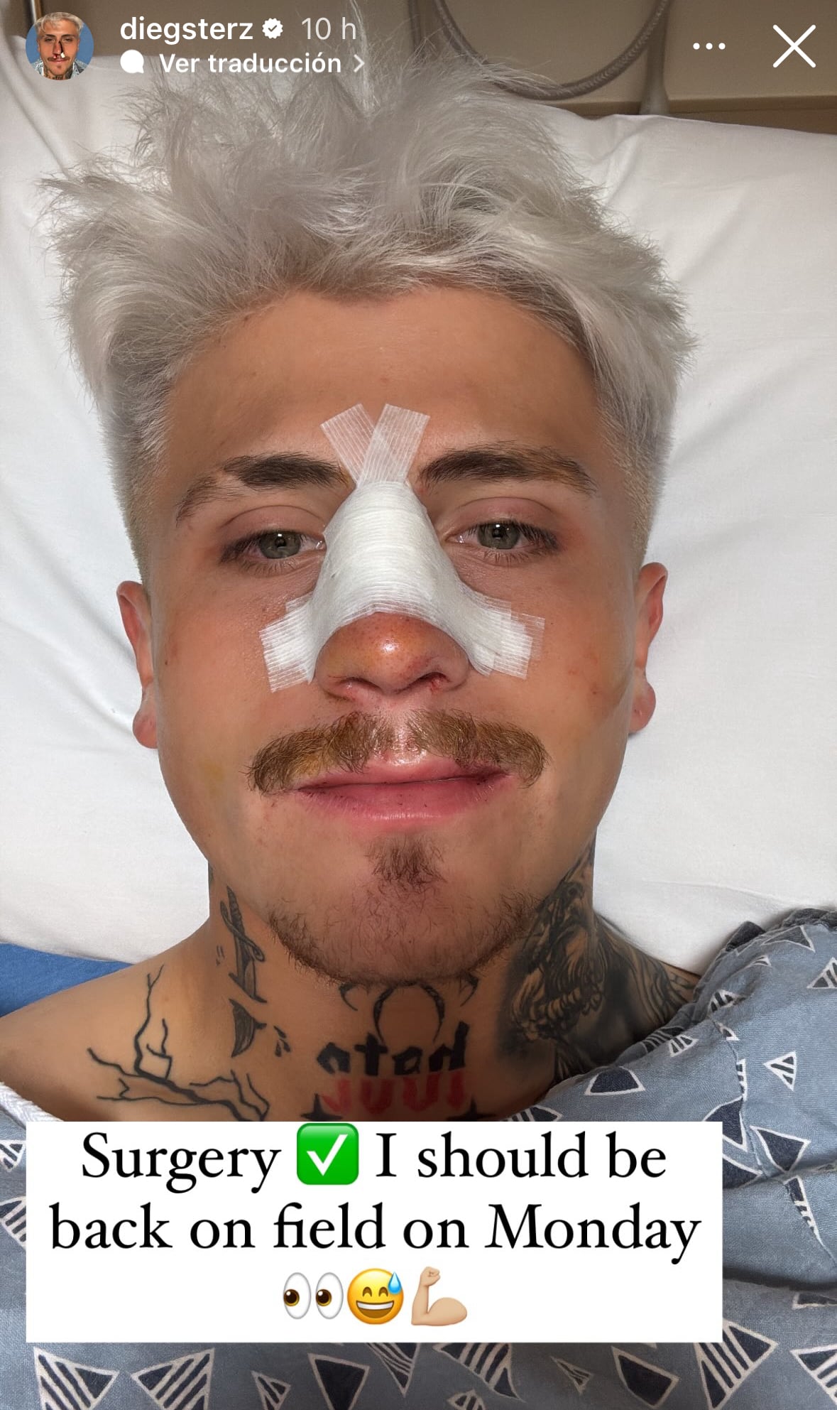 Diego Luna dio a conocer que ameritó una cirugía y que espera estar en cancha el próximo lunes.