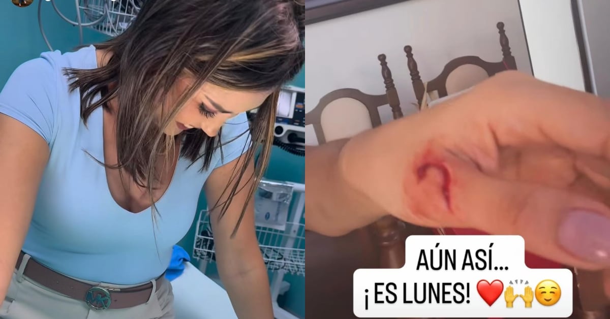 Ginnés Rodríguez mostró el corte en su mano.