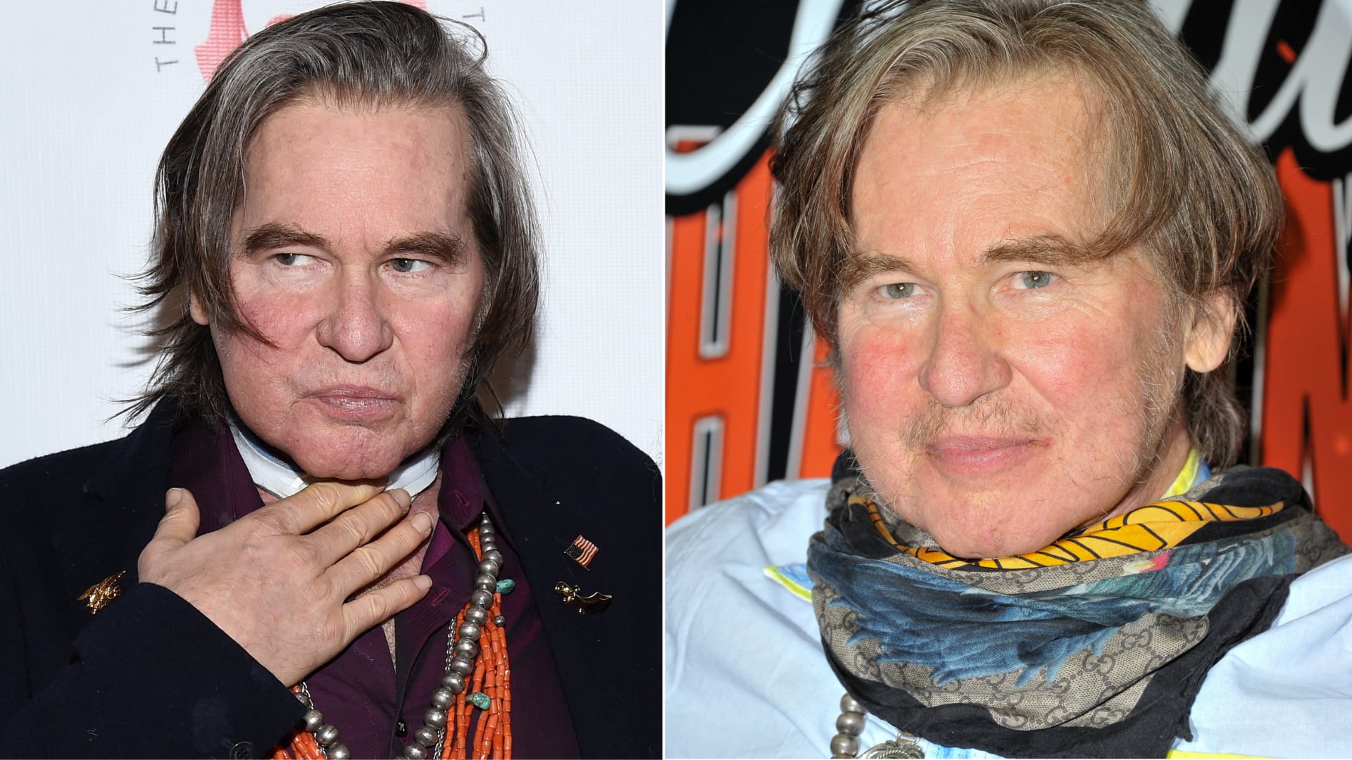 Retrato comparativo de Val Kilmer en distintos eventos públicos, con el rostro visiblemente afectado por un tumor en la garganta que ocultaba con bufandas, antes de fallecer en 2025 debido a complicaciones relacionadas con la enfermedad.
