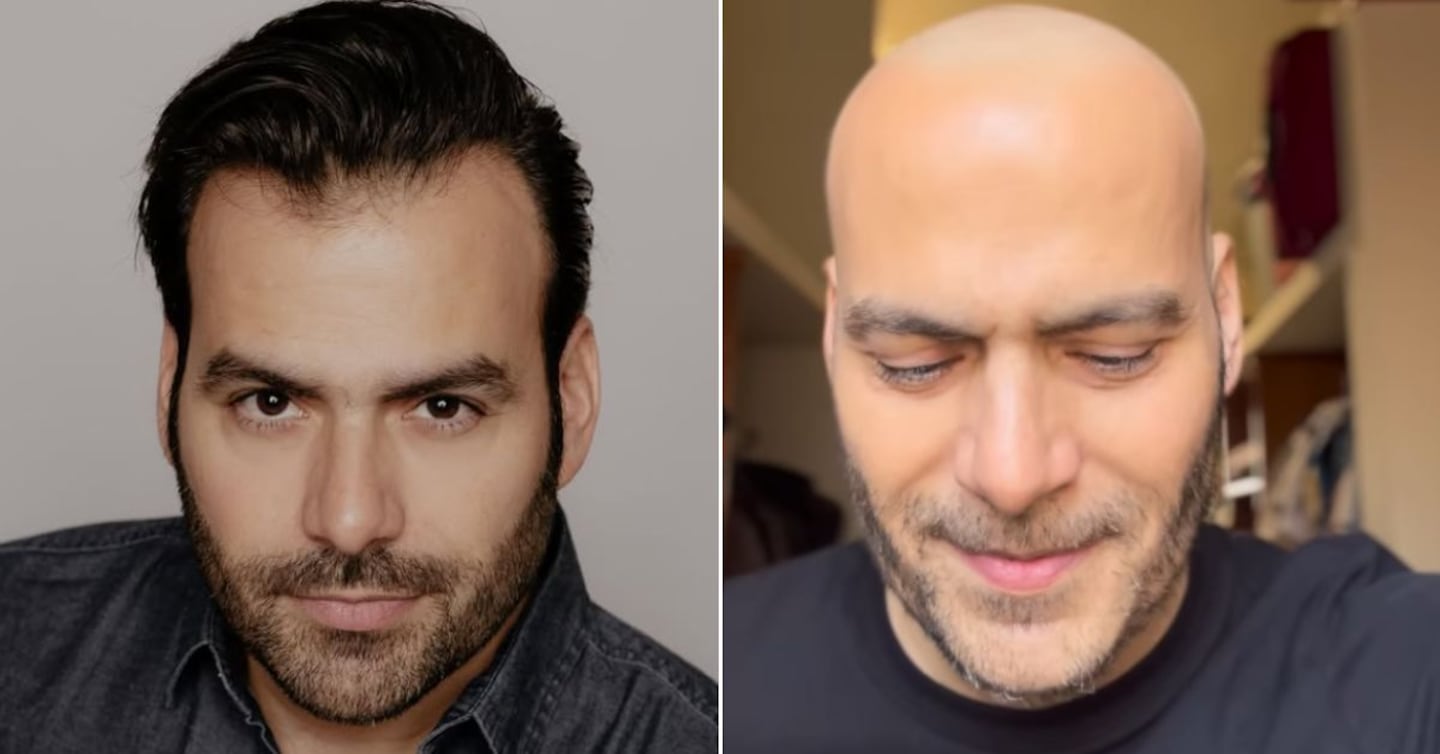 Impactante reaparición: famoso actor de telenovelas muestra los drásticos cambios que dejó su tratamiento contra el cáncer