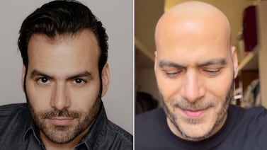 Impactante reaparición: famoso actor de telenovelas muestra los drásticos cambios que dejó su tratamiento contra el cáncer