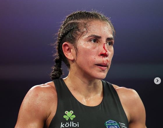 Yokasta Valle
María Santizo
Pelea por los títulos Mundiales
17 de setiembre del 2023
Golden Boy Promotions