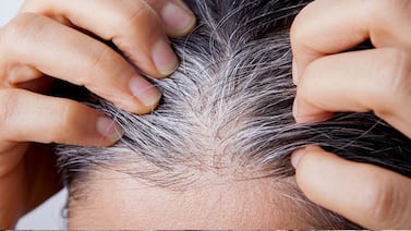 ¿Para qué sirve aplicar bicarbonato de sodio y romero en las canas y cómo hacerlo?