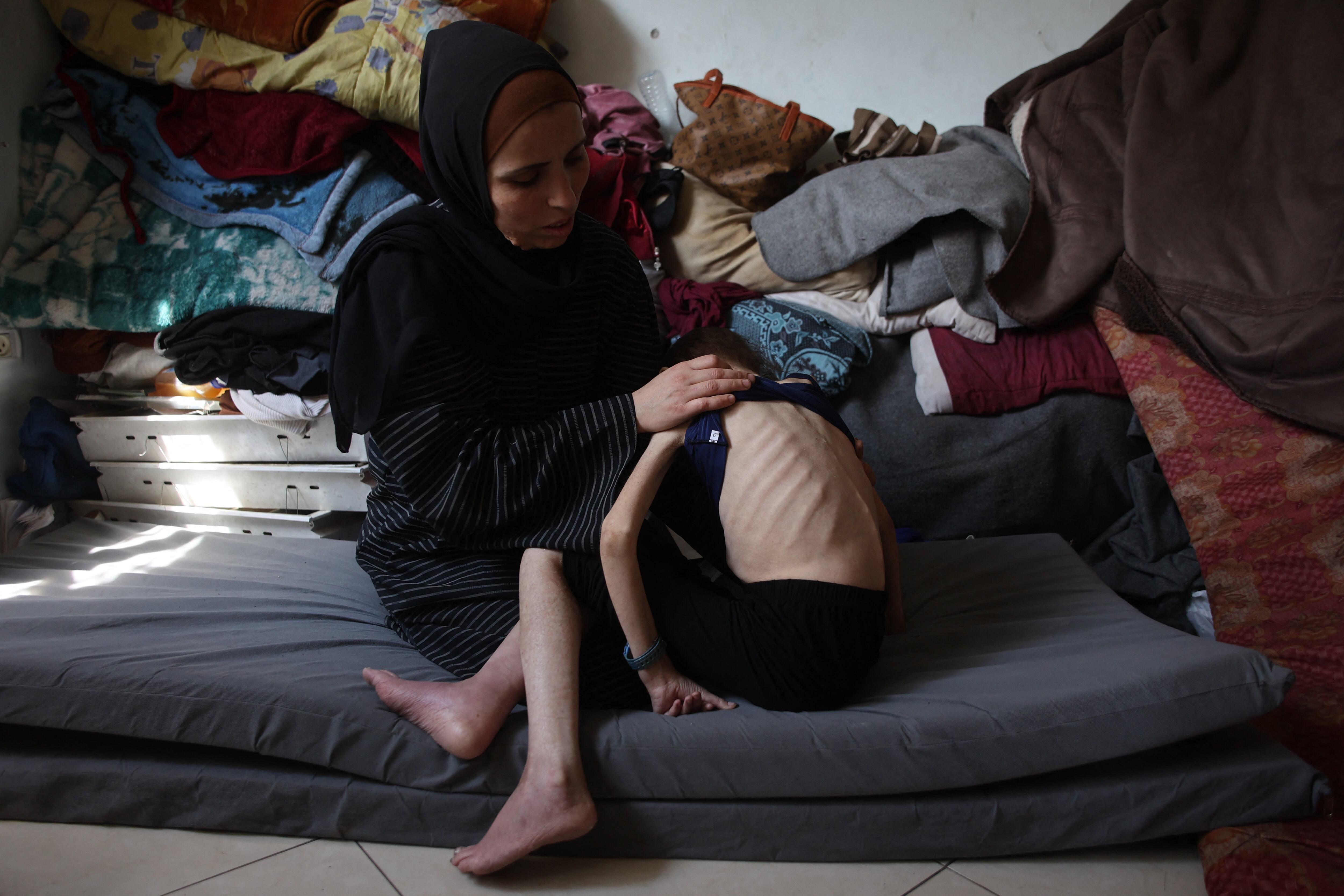 Shuruq Ayyad muestra las costillas salientes de su hija Rahaf, de 12 años, en una escuela convertida en albergue en al-Rimal, en el centro de la ciudad de Gaza, este 4 de mayo de 2025. Fotografía: