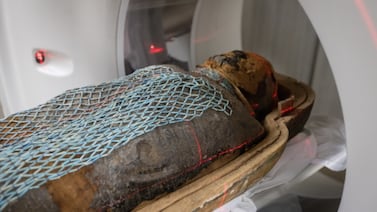 Tomografía a momias de 2.200 años revela severos problemas de espalda y cadera en sacerdotes egipcios