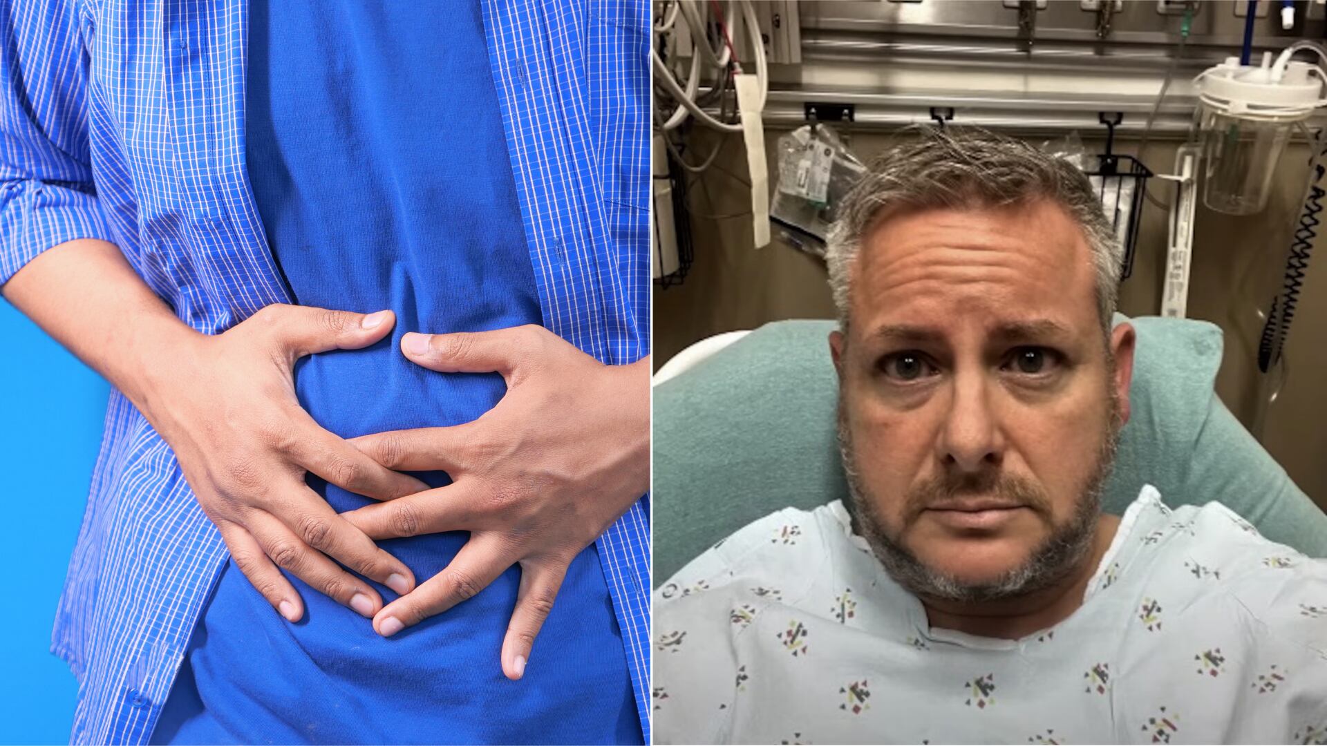 Kirkbride pensó que sufría de estreñimiento, pero los dolores abdominales intensos lo llevaron al hospital, donde recibió el diagnóstico de cáncer de colon en etapa avanzada.