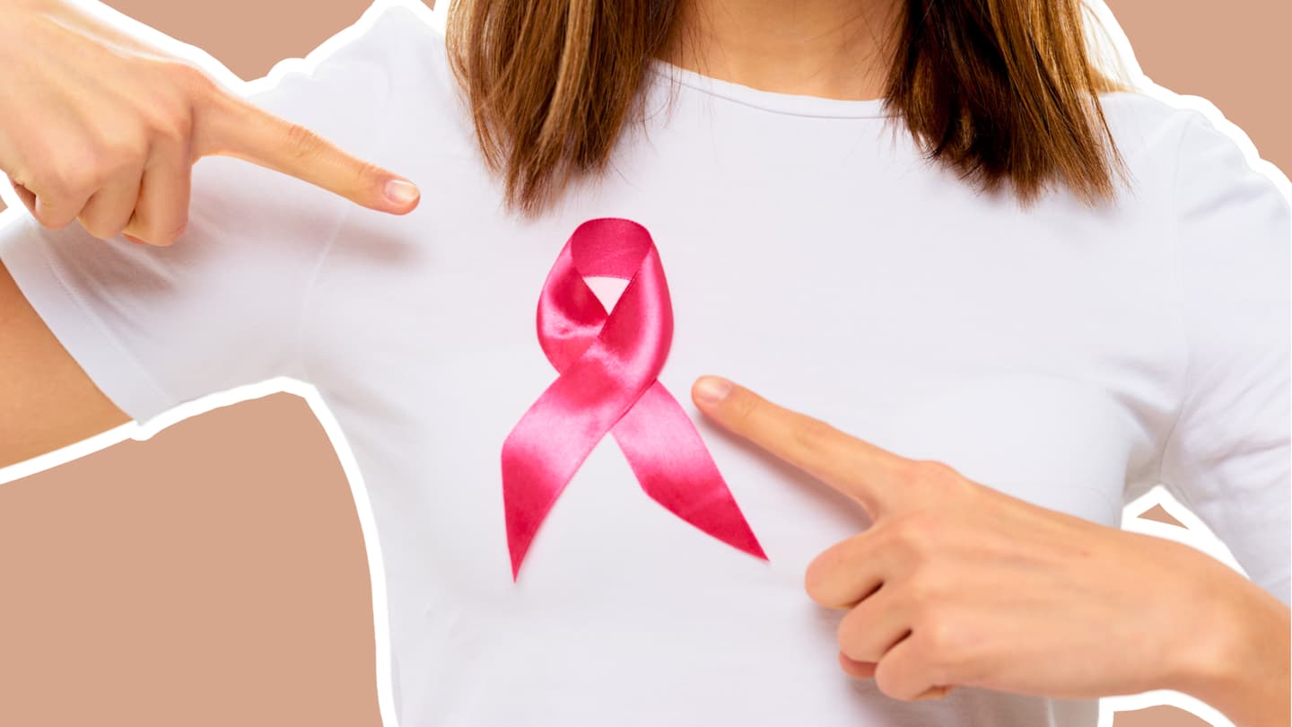 La cirugía es uno de los principales tratamientos contra el cáncer de mama y puede implicar retirar una parte o la totalidad de la mama, según cada caso.