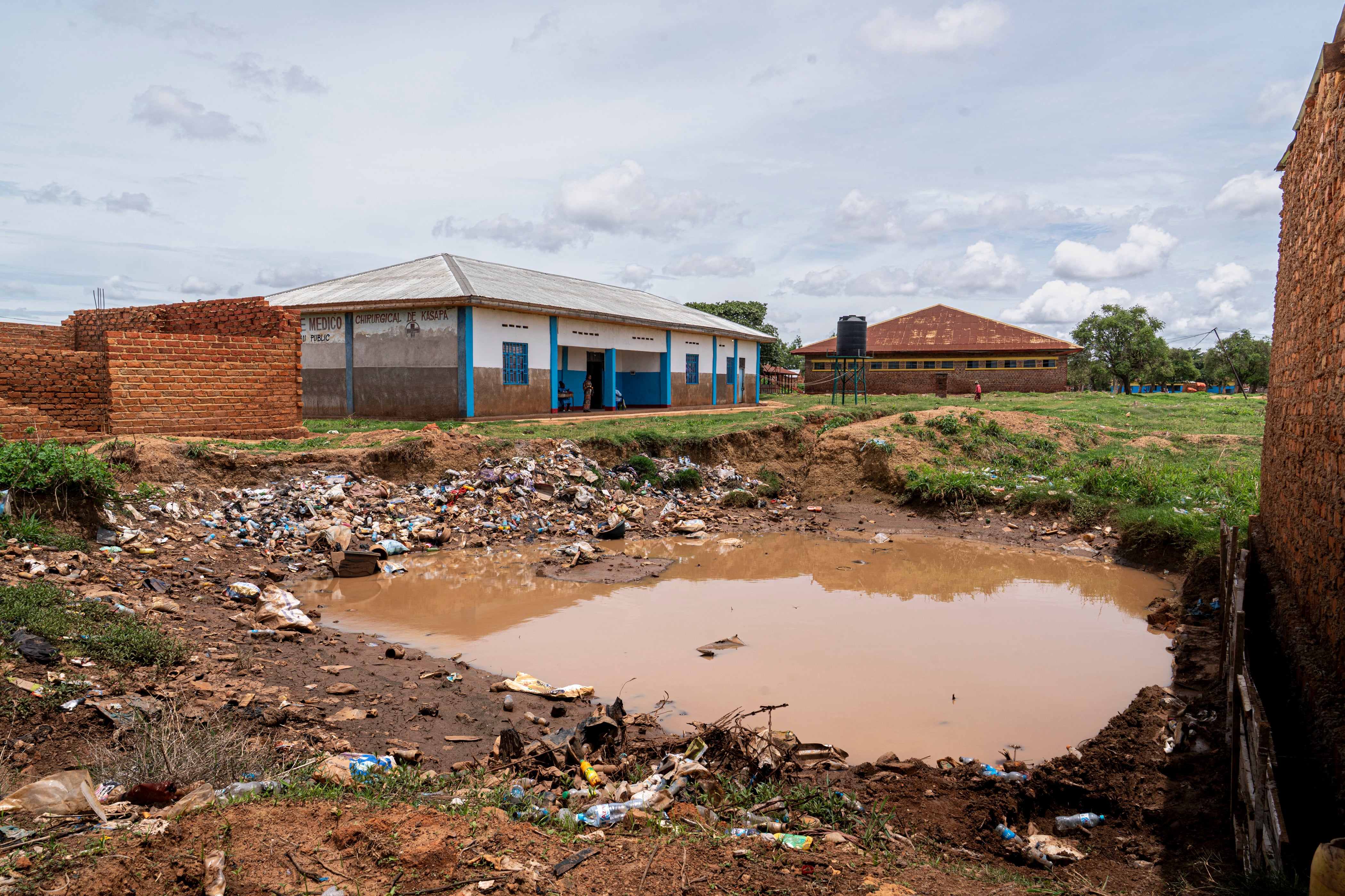 Un charco de agua estancada llena el patio exterior de un hospital en Lubumbashi el 24 de noviembre de 2025. Su campo reseco está invadido por los escombros arrastrados por las aguas contaminadas, y la niña que lleva en brazos está cubierta de llagas: en Lubumbashi, la capital minera de la República Democrática del Congo (RDC), miles de congoleños afirman ser víctimas de los residuos tóxicos de la industria minera.