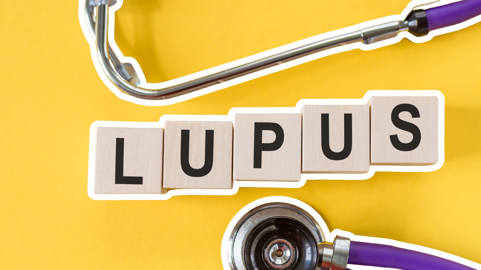 lupus Mi bienestar