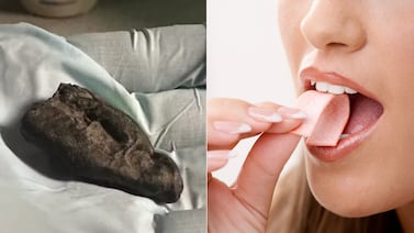 El ADN revela quién mascó un ‘chicle’ de hace 10.500 años