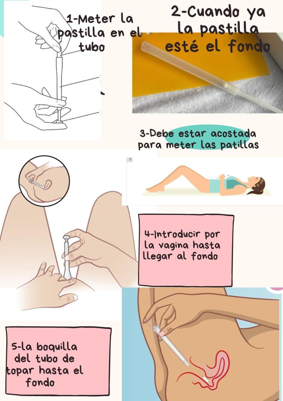 Ilustraciones sobre cómo practicar un aborto clandestino, según una tienda de venta de las pastillas misoprostol.