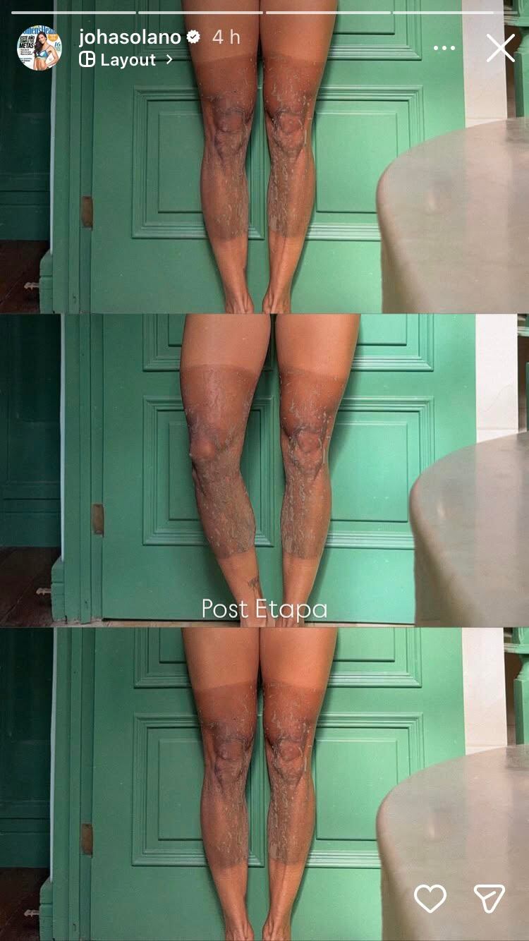 Johana Solano
Ruta de los Conquistadores 2025
Muesttra sus piernas tras la primera etapa de la Ruta de los Conquistadores
6 de noviembre 2025
Tomada de Instagram