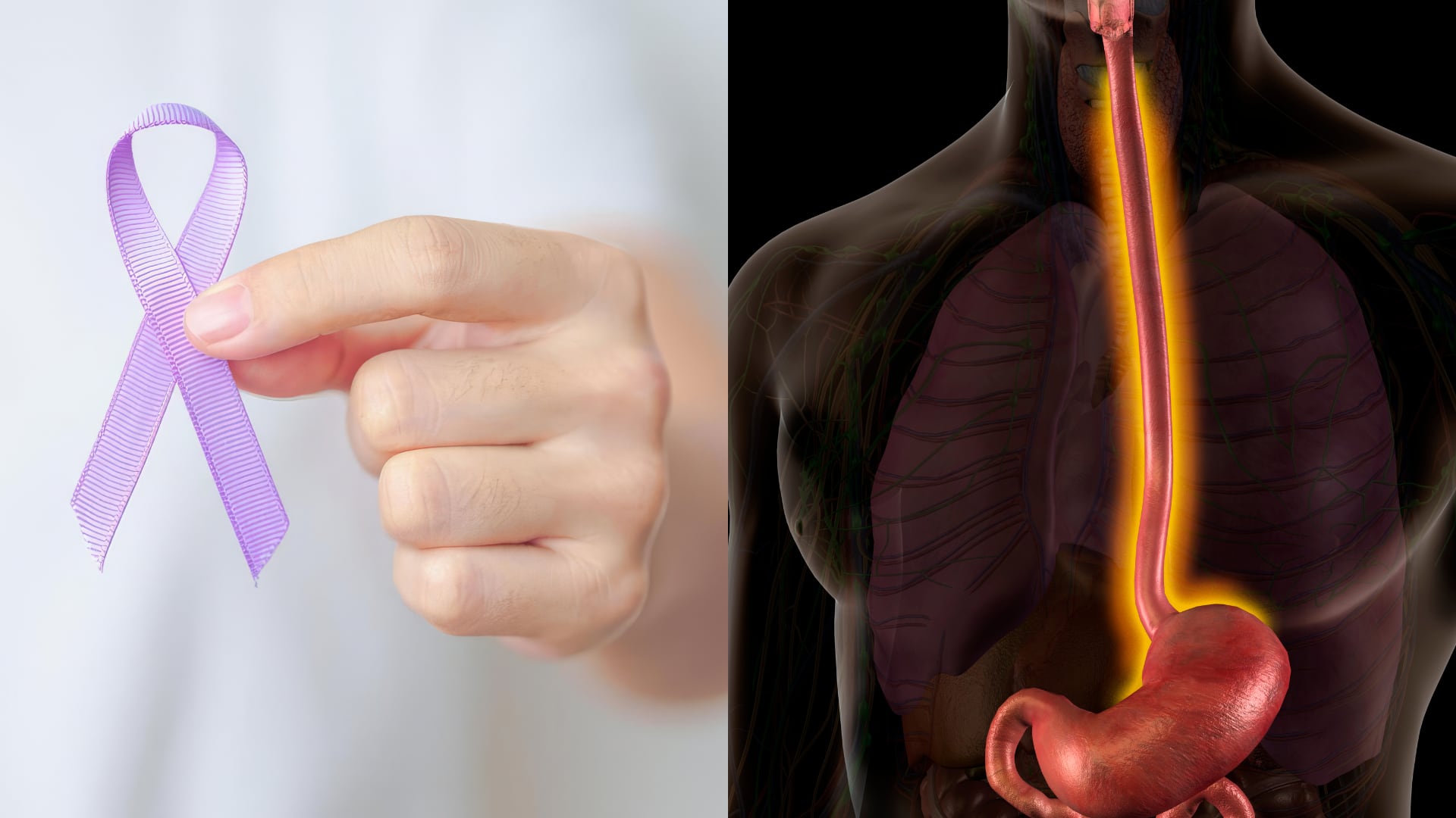 Mantener un peso saludable y evitar el exceso de alimentos ultraprocesados o muy grasosos ayuda a frenar el reflujo constante que “quema” y daña las paredes de su esófago.