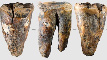 Neandertales usaban herramientas de piedra para aliviar caries hace 59.000 años, según estudio