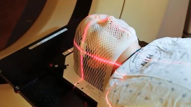 Vivió dos años con un temblor en el ojo sin saber que tenía un tumor en el cerebro