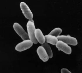 Haloarqueas, cada célula mide aproximadamente 5 μm de longitud.