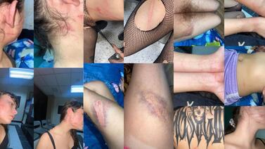 ‘Me golpearon, arrancaron el pelo y tocaron’: Joven denuncia agresión policial en Alajuela
